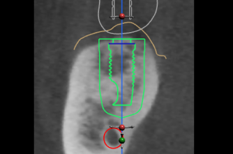 Mon 27 Mar '17: CBCT in Periodontics - Cavendish Imaging