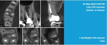 on the left six images of CBCT scans and on the right light blue box with white text with details of course