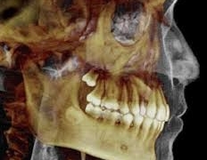 Fri 12 Jan ’18: CBCT Course for Referrers – Level 1