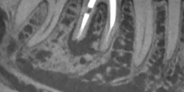 Diseased Anatomy and Diagnosis of Dental Alveolar Pathologies – 17 July, 2018