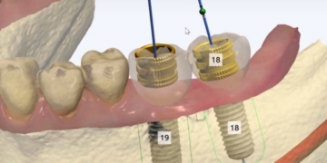 Mon 12 Feb ’18: An Introduction to Guided Surgery