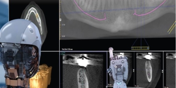 Revolutionising Dental Diagnostics: The Role of AI in CBCT Scan Reporting