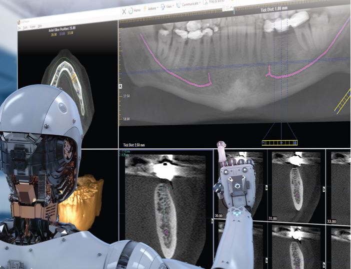 Revolutionising Dental Diagnostics: The Role of AI in CBCT Scan ...