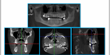 The Evolution of Dental Imaging: From Panoramics to CBCT Scans and Beyond