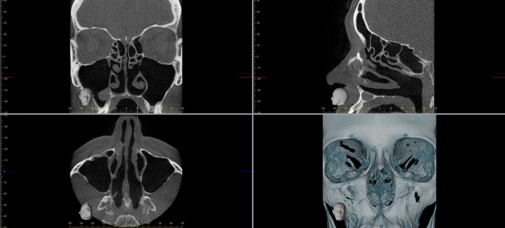 4 images of a skull from different angles