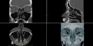 Level 1 & Level 2 Dental CBCT Training