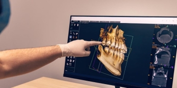 Key Aspects of a Dental CBCT Radiology Report: What You Need to Know