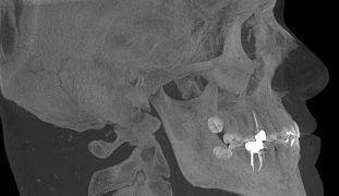 CBCT Scans in Oral and Maxillofacial Surgery: Advanced Applications for UK Dental Professionals