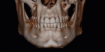 Understanding Normal Anatomy on Dental CBCT: A Practical Guide for Clinicians
