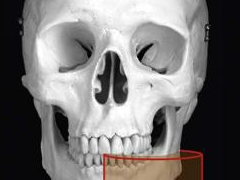 CBCT Interpretation of Small Volumes – 22 May, 2018