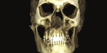 The Role of Imaging in the Management of Facial Asymmetry