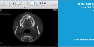 Use CBCT Software on Your Apple Mac