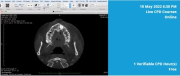 on the left a black and white CBCT scan of mouth and on the right a light blue box with white text explaining the details of course