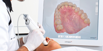 The Benefits of Intra-Oral and Study Model Scanning – 10 Oct, 2018