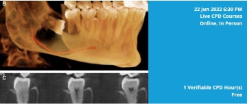 on the left four image of jaw and teeth and on the left a light blue box with white text with details of session