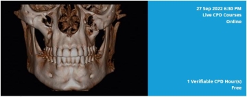 on the left an image of a scan of a skull facing forward and on the right a light blue box with white text with details on event