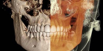 CBCT Interpretation – Normal Anatomy – 26 June, 2018