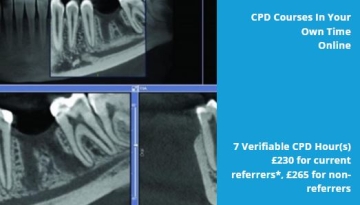 on the left a three cbct images of teeth and on the right a light blue box with white text describing the event details