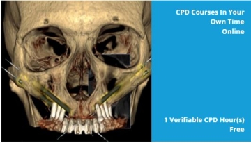 Maxillary and Zygomatic Implants for Dental Nurses - Cavendish Imaging