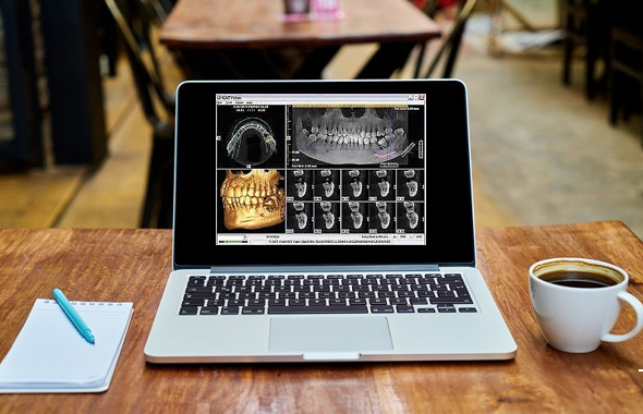 image of a laptop with cbct scans on the screen sitting on a wood table